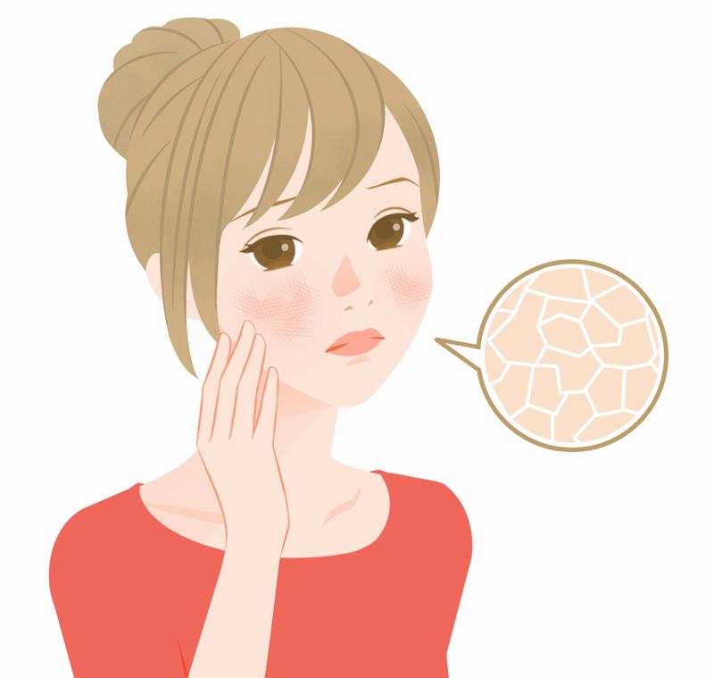 肌の荒れが気になるミドル世代の女性